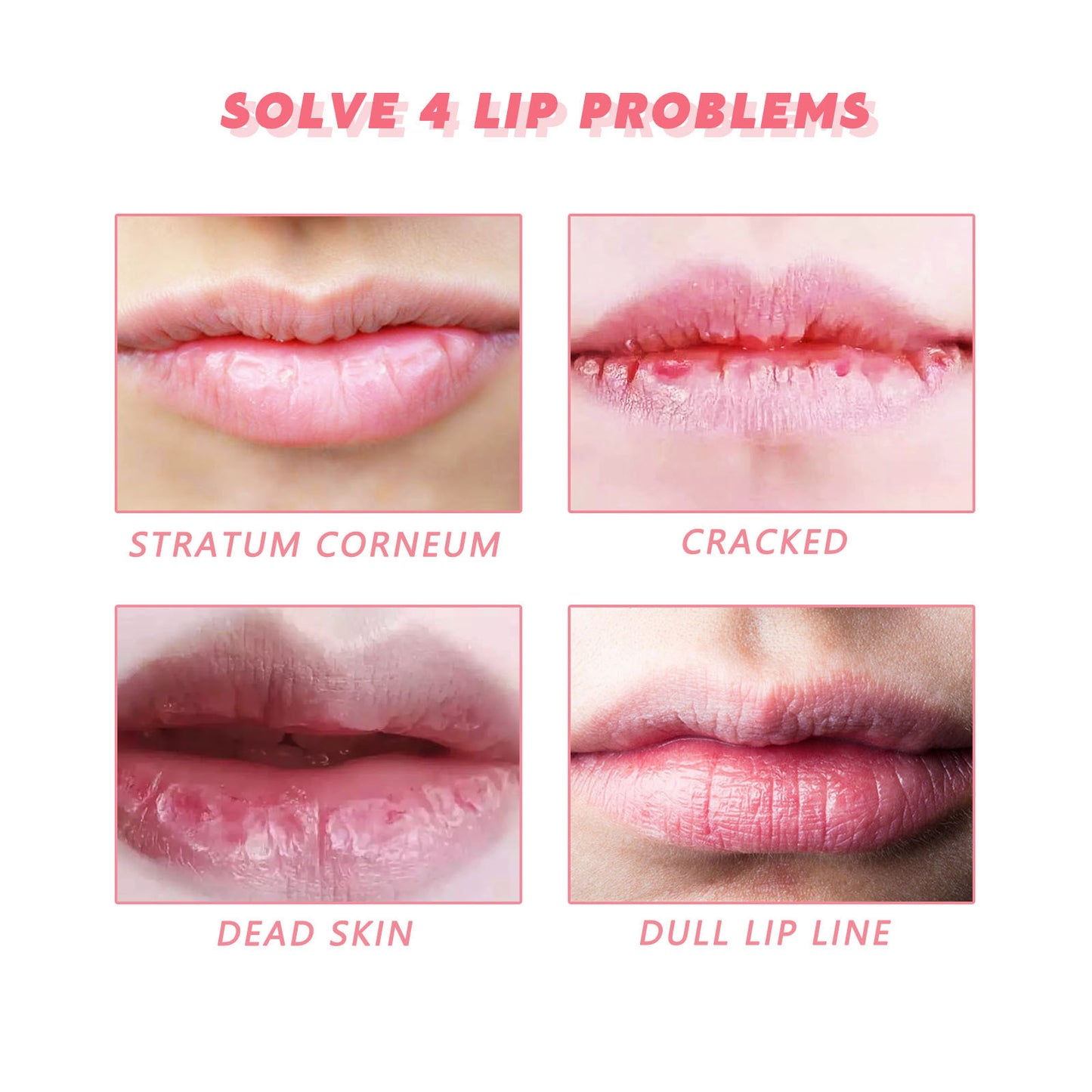 Peach lip scrub moisturizes and dilutes lip lines, removes dead skin, brightens lips, moisturizes lips and softens lips