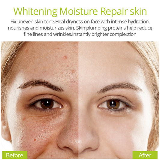 VIBRANT GLAMOUR Vitamin C Anti-acne Original Liquid Moisturizing Antioxidant Repair Serum