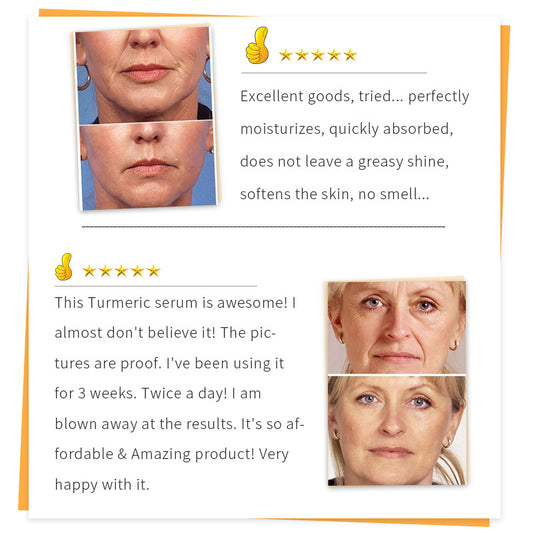 Cross-border spot SAUVASINE wrinkle Turmeric Serum moisturizing turmeric essence liquid manufacturers wholesale