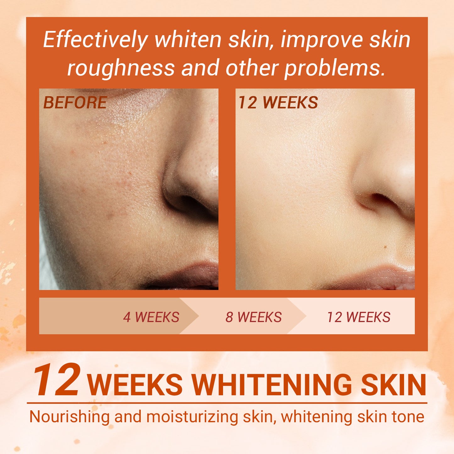EELHOE Vitamin C Moisturizing Spray Moisturizes the skin, fades acne spots, rejuvenates the skin and whitens the spray
