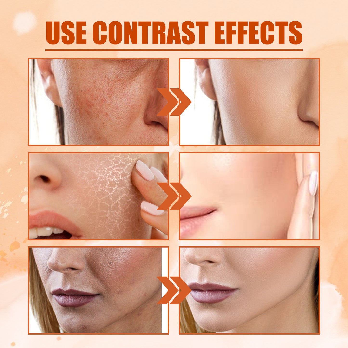 EELHOE Vitamin C Moisturizing Spray Moisturizes the skin, fades acne spots, rejuvenates the skin and whitens the spray
